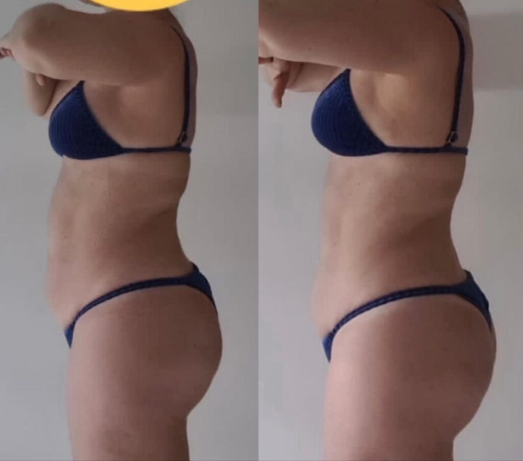 V.M | 30 anos